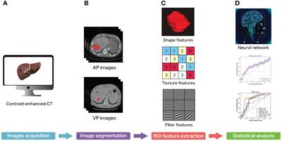 Preoperative prediction for early recurrence of hepatocellular carcinoma using machine learning-based radiomics